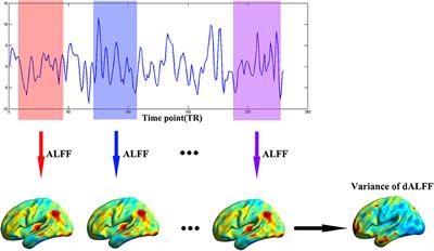Increased Dynamic Amplitude of Low Frequency Fluctuation in Primary Insomnia